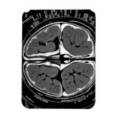 MRI脳スキャン マグネット (縦)