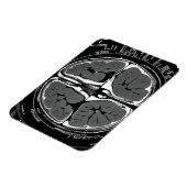 MRI脳スキャン マグネット (左側)