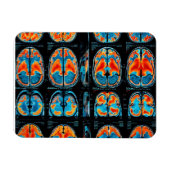 MRI脳スキャン マグネット (横)