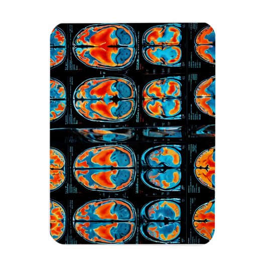 MRI脳スキャン マグネット (縦)