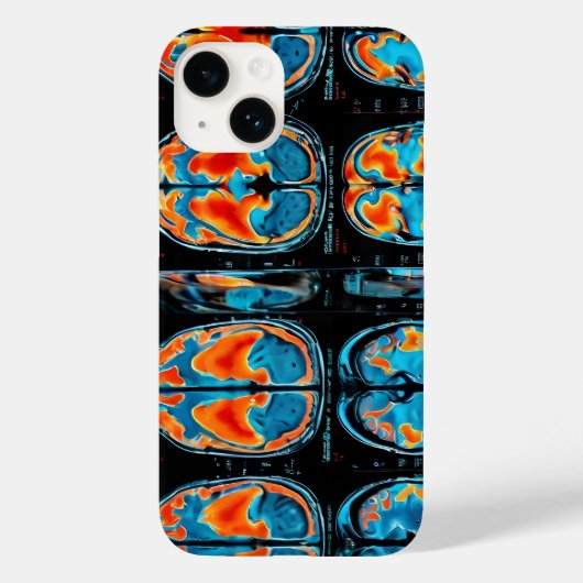 MRI脳スキャン Case-Mate iPhoneケース (裏面)