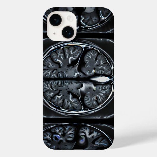 MRI脳スキャン Case-Mate iPhoneケース (裏面)