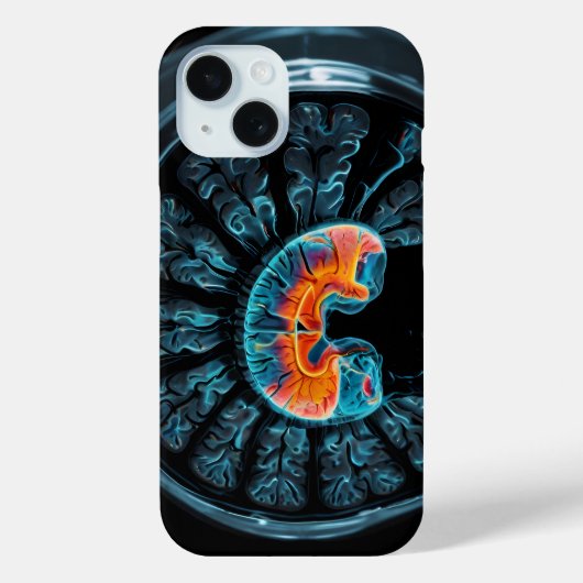 MRI 脳スキャン Case-Mate iPhoneケース (裏面)