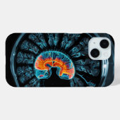 MRI 脳スキャン Case-Mate iPhoneケース (裏面 (横))