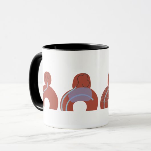Mug de Aneurismas マグカップ (正面左)