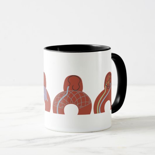 Mug de Aneurismas マグカップ (正面右)