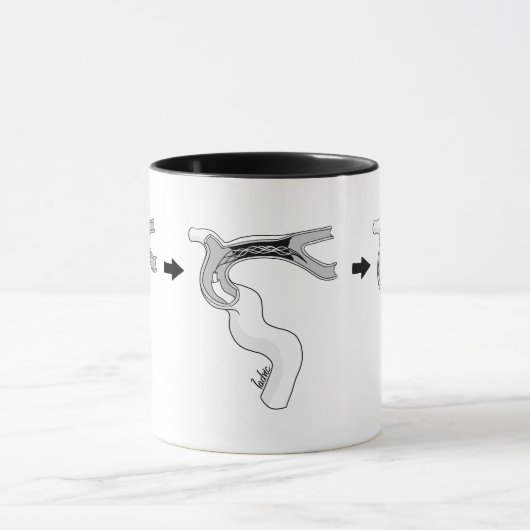 Mug de Trombectomía マグカップ (中央)