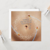 My Universe カード (正面/裏面インサイチュ)