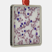 Neoplasticリンパ球の細胞 メタルオーナメント (右)