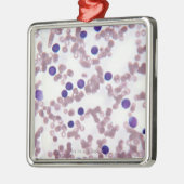 Neoplasticリンパ球の細胞 メタルオーナメント (左)