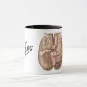 Netter Basal View of Brain  - Mug マグカップ (中央)