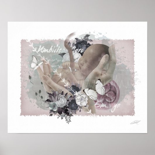 Obgynポスター ポスター (正面)