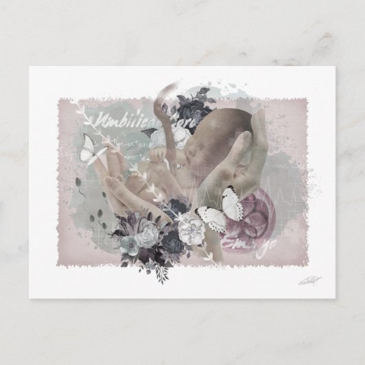 「OBGYN」ポストカード ポストカード (正面)