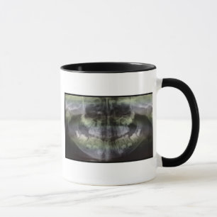 OPGのコーヒー・マグ マグカップ