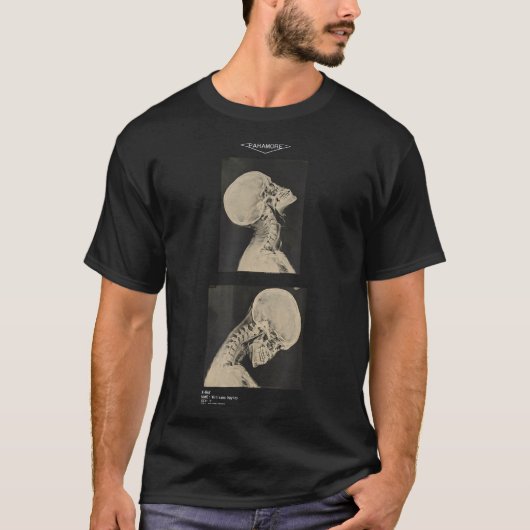 Paramore クロップド ヘッドバンガー X線 ドクターズ Tシャツ (正面)