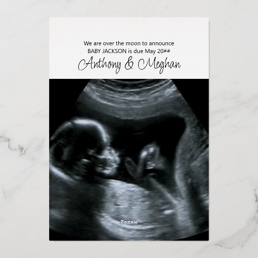 Peace Love Bundle of Joy 2 Photo Expecting 箔シーズンカード (裏面)