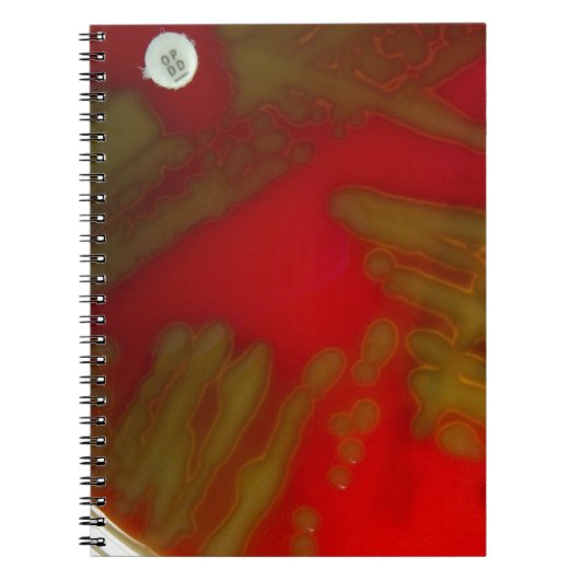 Penumoniaの細菌 ノートブック (正面)