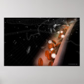 Plaque in the arteries ポスター (正面)