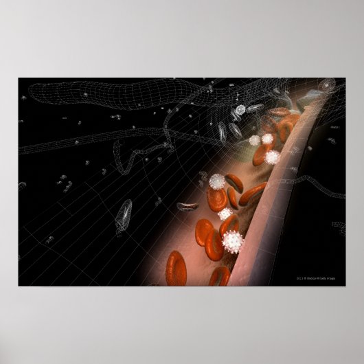 Plaque in the arteries ポスター (正面)