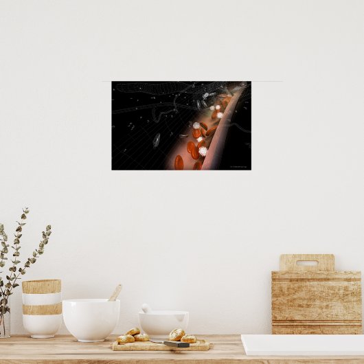 Plaque in the arteries ポスター (キッチン)