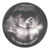 Pregnancy Baby Sonogram Ultrasound Father’s Day アイスホッケーパック (正面)