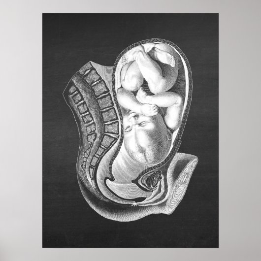 Pregnancy Womb Anatomy Obstetric Decor no.1 ポスター (正面)
