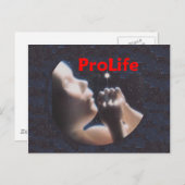 ProLifeはがき ポストカード (正面/裏面)
