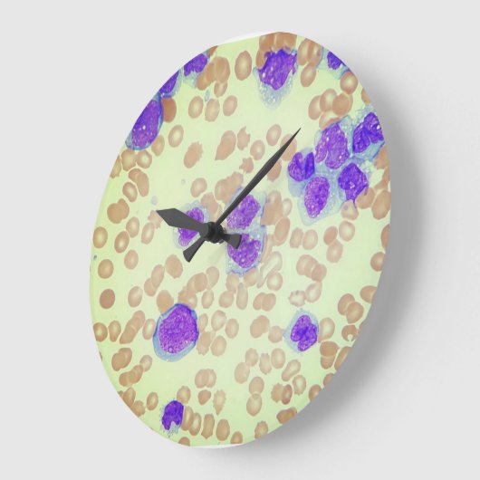 RBCs WBCsスライド顕微鏡血液学研究室 ラージ壁時計 (傾斜)