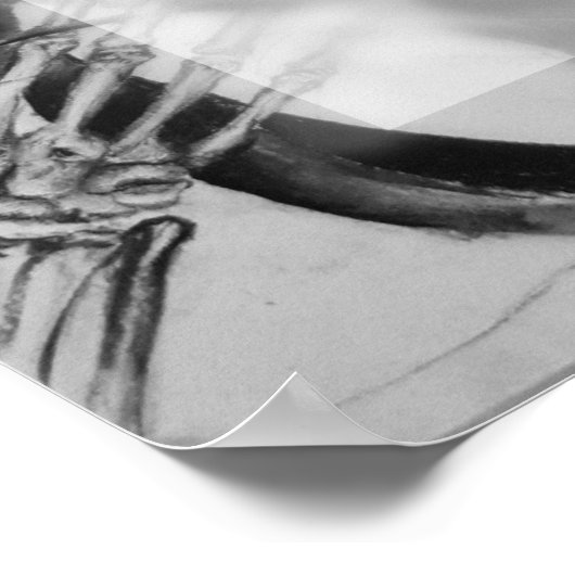 RD患者声詩ポスター ポスター (角)