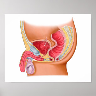 Rectourethral Fistulaの医学のイラストレーション ポスター