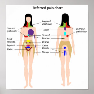 Referred pain chart Poster ポスター