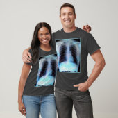 RibcageのX線のワイシャツ Tシャツ (ユニセックス)