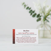 RSD/CRPSの医学カード コーリングカード (スタンド正面)