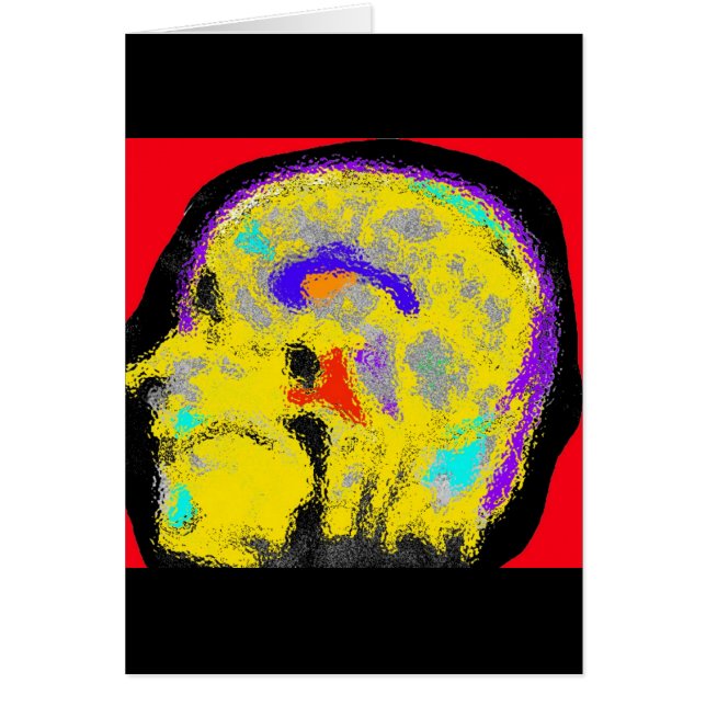 sagital MRI (正面)