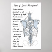 Signs of Spinal Misalignment Chiropractic ポスター (正面)