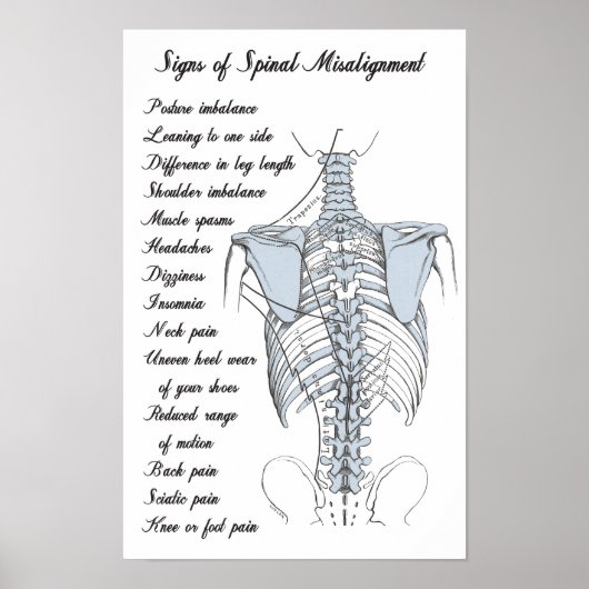 Signs of Spinal Misalignment Chiropractic ポスター (正面)