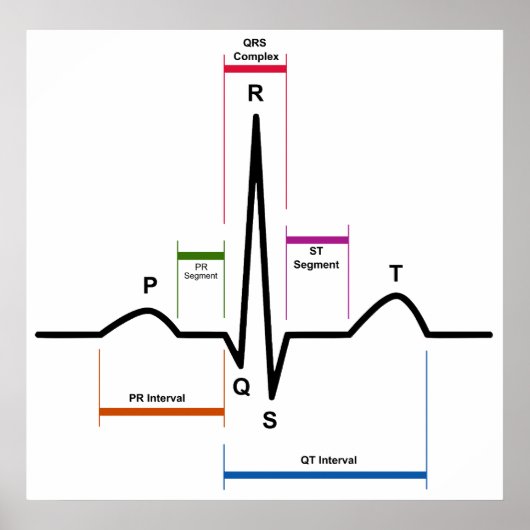 Sinus Rhythm in an Electrocardiogram ECG Diagram ポスター (正面)