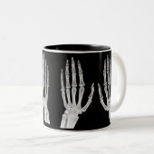 Skeleton Hands Xray Picture Human Anatomy photo ツートーンマグカップ (正面右)