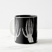 Skeleton Hands Xray Picture Human Anatomy photo ツートーンマグカップ (正面左)