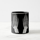 Skeleton Hands Xray Picture Human Anatomy photo ツートーンマグカップ (中央)