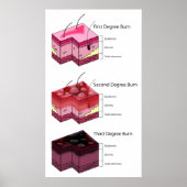 Skin Burn First Second & Third Degree Diagram ポスター (正面)