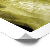 Spinal Degeneration Cervical Spine Chiropractic ポスター (角)