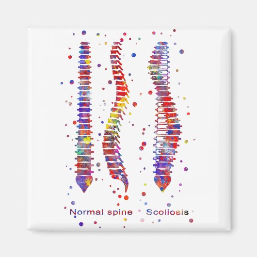 Spine マグネット (正面)