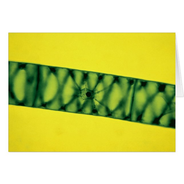 Spirogyraの緑藻類 (正面横)