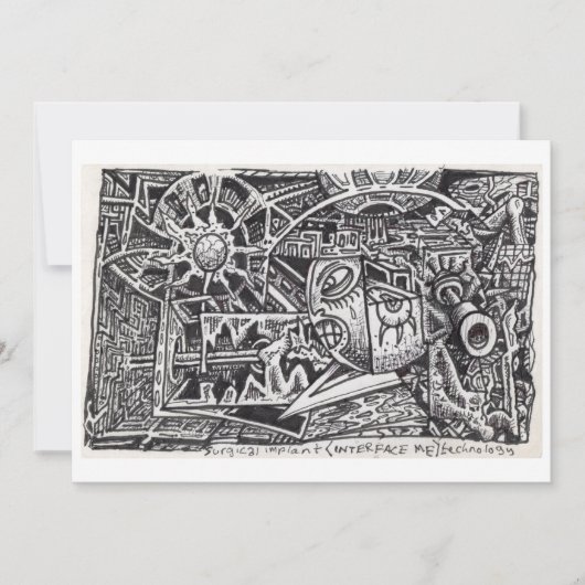 Surgical Implant (Interface Me) Technology (正面)