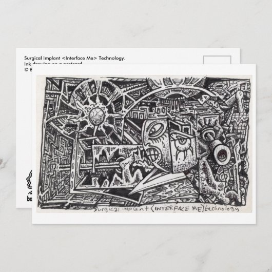 Surgical Implant (Interface Me) Technology (正面/裏面)