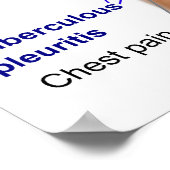 Symptom Chart of Tuberculosis in Humans ポスター (角)