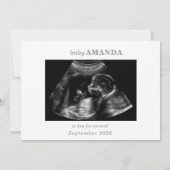 Taupe Muted Gray Ultrasound Photo Pregnancy Card 招待状 (裏面)
