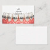 Teeth Braces Orthodontics Dentist Business Card 名刺 (正面/裏面)