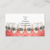 Teeth Braces Orthodontics Dentist Business Card 名刺 (正面)